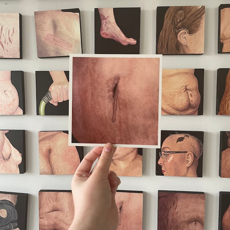 Surgery Scar Print