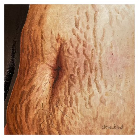 Stretch Marks Print 1