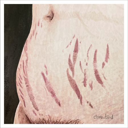 Stretch Marks Print 3